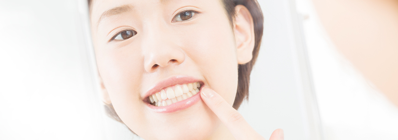 セラミックの詰め物、被せ物は虫歯予防にも効果的です。