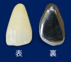 プラスチック前装冠
